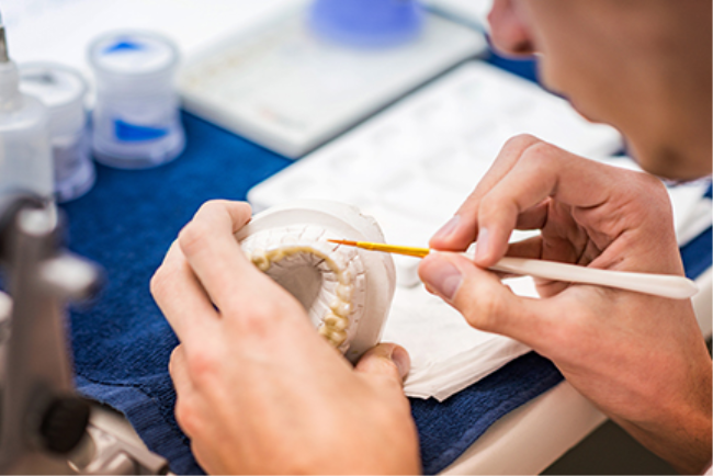 טכנאי שיניים מתכנן ציפויים לשיניים במסגרת טיפול לשיפור האתסטיקה הדנטלית